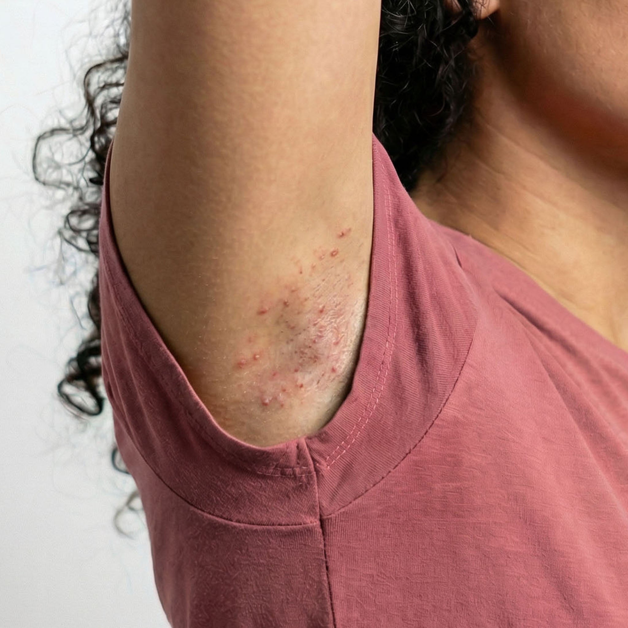 Before — skin irritation